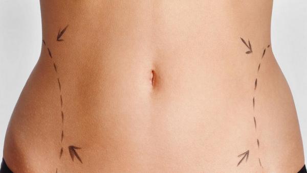 Вакуумный массаж для похудения помогут ли банки похудеть в боках и животе