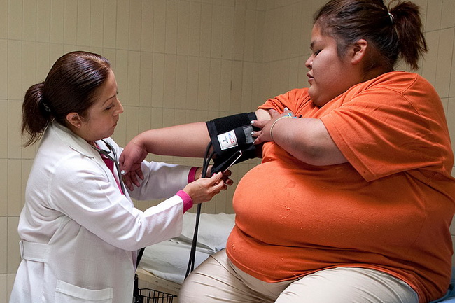 Морбидное ожирение 5 видов лечения которые помогут победить болезнь и её последствия