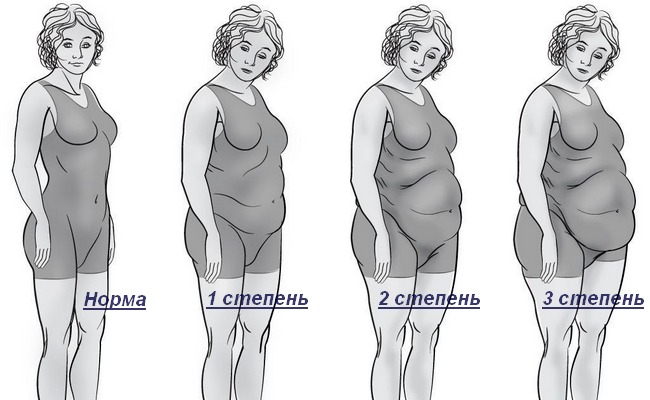 Обзор классификаций ожирения его типы виды и степени в зависимости от разных характеристик заболевания