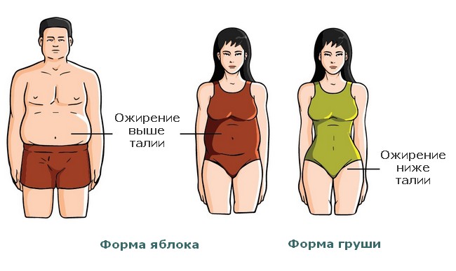 Форма ожирения Яблоко и Груша
